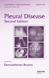 Abbildung von: Pleural Disease - CRC Press