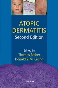 Enlarge image Cover: Atopic Dermatitis - CRC Press