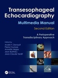 Bild: Transesophageal Echocardiography Multimedia Manual - CRC Press