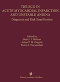 Cover: The ECG in Acute Myocardial Infarction and Unstable Angina - Kluwer Academic Publishers