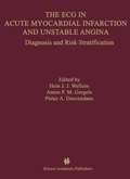 Cover: The ECG in Acute Myocardial Infarction and Unstable Angina - Springer