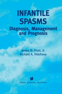 Abbildung von: Infantile Spasms - Springer
