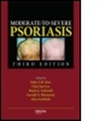 Cover: Moderate-to-Severe Psoriasis - Informa Healthcare