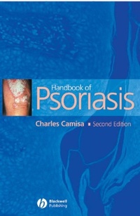 Abbildung von: Handbook of Psoriasis - Wiley