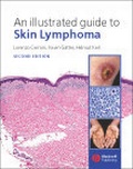 Cover: An Illustrated Guide to Skin Lymphoma - Wiley-Blackwell