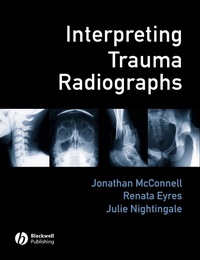 Enlarge image Cover: Interpreting Trauma Radiographs - Wiley