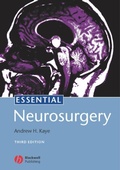 Cover: Essential Neurosurgery - Wiley