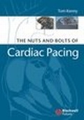 Bild: The Nuts and Bolts of Cardiac Pacing - Blackwell Futura