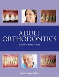 Enlarge image Cover: Adult Orthodontics - Wiley-Blackwell