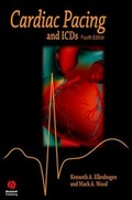 Bild: Cardiac Pacing and ICDs - Wiley-Blackwell