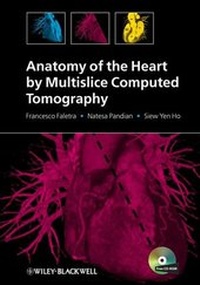 Abbildung von: Anatomy of the Heart by Multislice Computed Tomography - Wiley-Blackwell