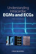 Cover: Understanding Intracardiac EGMs and ECGs - Wiley-Blackwell