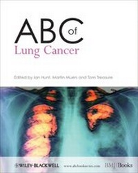 Enlarge image Cover: ABC of Lung Cancer - BMJ Books