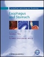 Bild: Practical Gastroenterology and Hepatology - Esophagus and Stomach V1 - Wiley-Blackwell