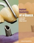 Cover: Implant Dentistry at a Glance - Wiley