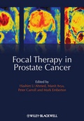 Cover: Focal Therapy in Prostate Cancer - Wiley-Blackwell