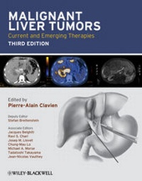 Abbildung von: Malignant Liver Tumors - Wiley-Blackwell