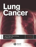 Cover: Lung Cancer - Wiley-Blackwell