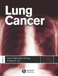Enlarge image Cover: Lung Cancer - Wiley-Blackwell