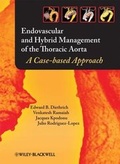 Bild: Endovascular and Hybrid Management of the Thoracic Aorta - Wiley-Blackwell