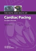 Cover: The Nuts and Bolts of Cardiac Pacing - Wiley-Blackwell
