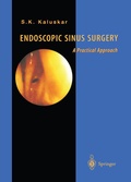 Cover: Endoscopic Sinus Surgery - Springer