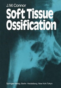 Enlarge image Cover: Soft Tissue Ossification - Springer