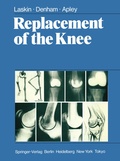 Cover: Replacement of the Knee - Springer
