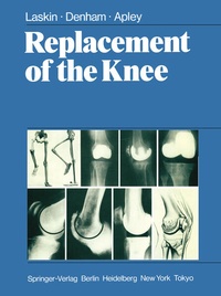Enlarge image Cover: Replacement of the Knee - Springer