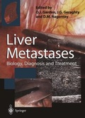 Cover: Liver Metastases - Springer