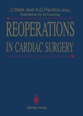 Bild: Reoperations in Cardiac Surgery - Springer