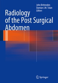 Abbildung von: Radiology of the Post Surgical Abdomen - Springer