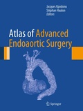 Bild: Atlas of Advanced Endoaortic Surgery - Springer