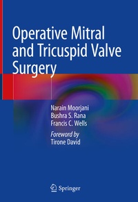 Abbildung von: Operative Mitral and Tricuspid Valve Surgery - Springer
