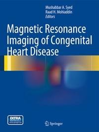Abbildung von: Magnetic Resonance Imaging of Congenital Heart Disease - Springer