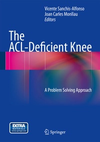 Abbildung von: The ACL-Deficient Knee - Springer