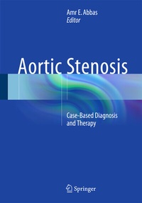 Abbildung von: Aortic Stenosis - Springer