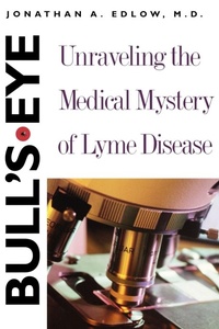 Enlarge image Cover: Bull's-Eye - Yale University Press