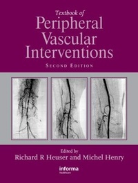 Enlarge image Cover: Textbook of Peripheral Vascular Interventions - CRC Press