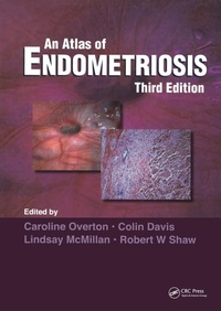 Abbildung von: Atlas of Endometriosis - CRC Press