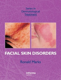 Enlarge image Cover: Facial Skin Disorders - CRC Press