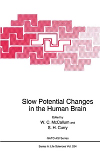 Abbildung von: Slow Potential Changes in the Human Brain - Springer