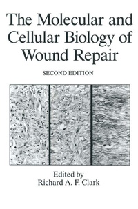 Abbildung von: The Molecular and Cellular Biology of Wound Repair - Springer