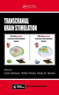 Abbildung von: Transcranial Brain Stimulation - CRC Press