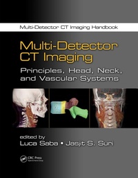 Abbildung von: Multi-Detector CT Imaging - CRC Press