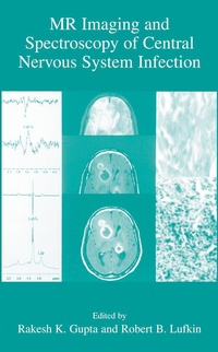 Enlarge image Cover: MR Imaging and Spectroscopy of Central Nervous System Infection - Plenum Publishing Co.,N.Y.