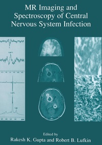 Enlarge image Cover: MR Imaging and Spectroscopy of Central Nervous System Infection - Springer