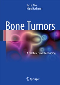 Abbildung von: Bone Tumors - Springer