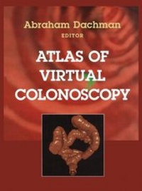 Abbildung von: Atlas of Virtual Colonoscopy - Springer