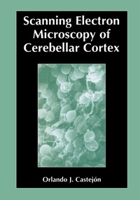 Abbildung von: Scanning Electron Microscopy of Cerebellar Cortex - Springer